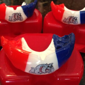Mouthguard Custom- Sports